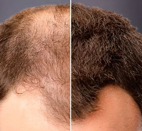 Цветной загуститель камуфляж для волос Toppik (черный) Black