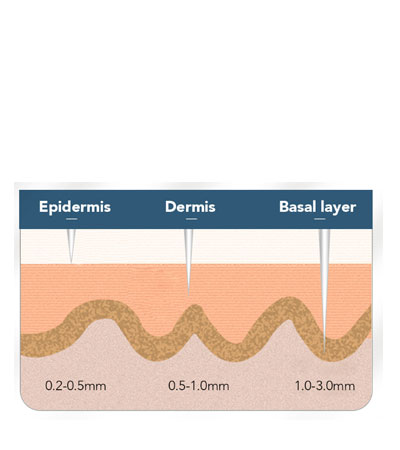 Мезороллер NR-DRS540 Derma Roller DRS Titanium